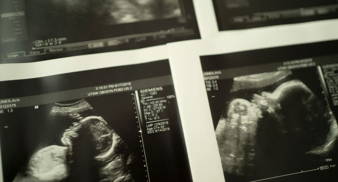 NIH Launches Multimillion-Dollar Initiative to Reduce Stillbirth Rate
